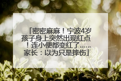 密密麻麻！宁波4岁孩子身上突然出现红点！连小便都变红了……家长：以为只是摔伤